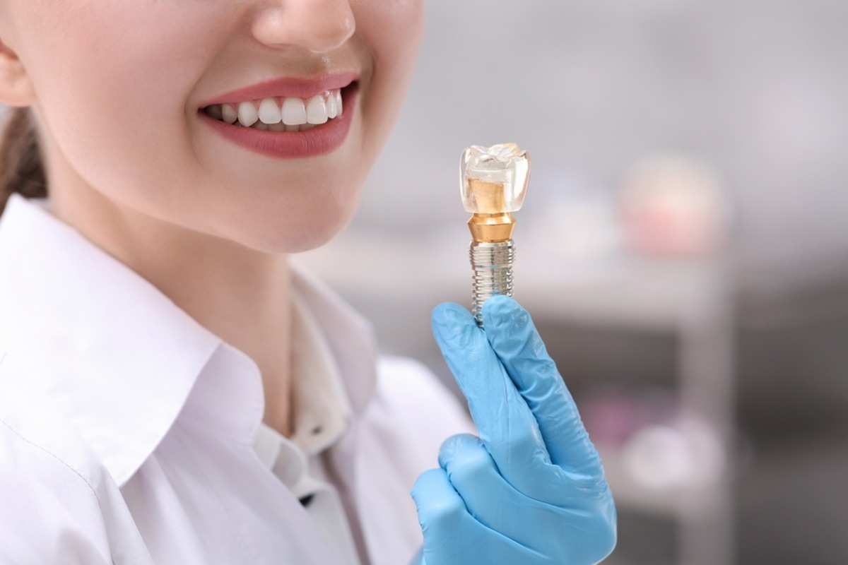 getting a dental implant here s what you should know