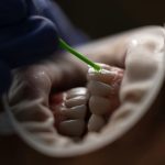 understanding common dental procedures what to expect at your next visit