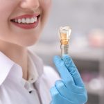 why dental implants are the best solution for missing teeth