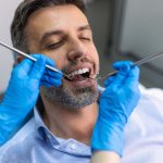how to remove black spots on teeth safely