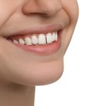 can cosmetic dentistry fix gaps between teeth
