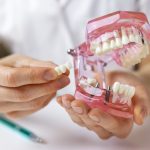 are dental bridges the right solution for your missing teeth