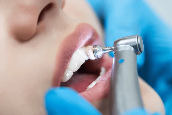 dental exams cleanings near you