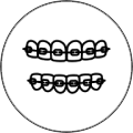 invisalign