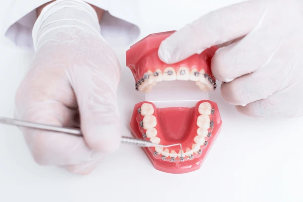 traditional braces near you