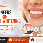 veneers vs teeth whitening which is right for your smile in red deer